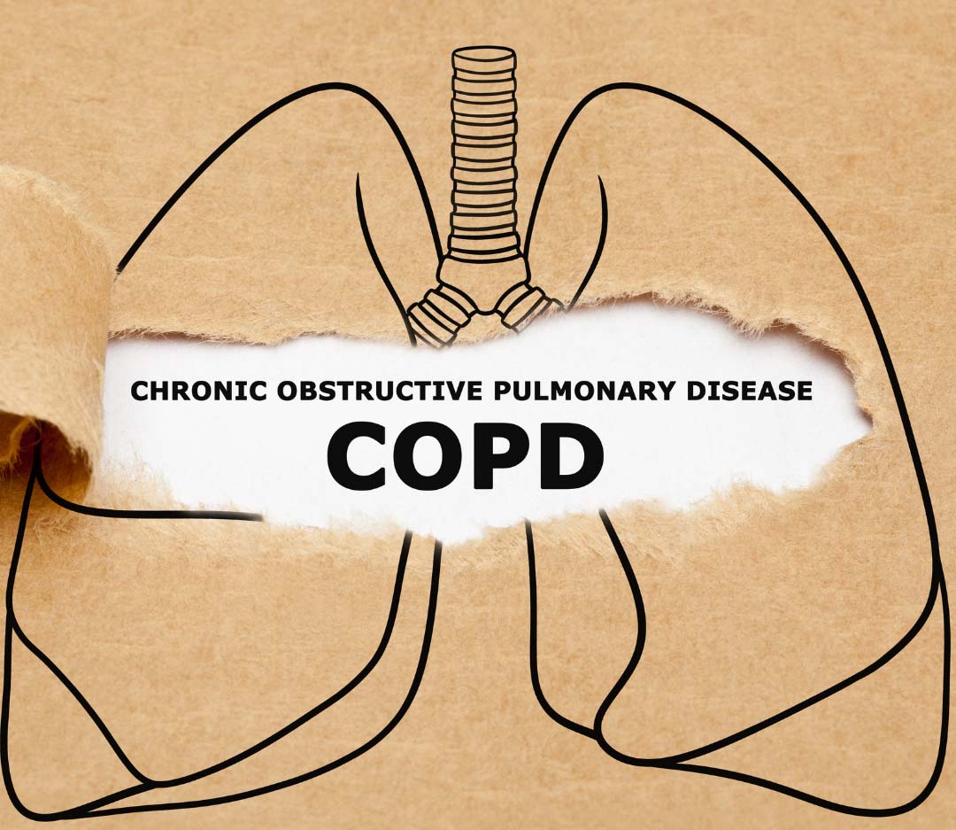 How to Live Well & Breathe Easier With COPD - Home Care Assistance